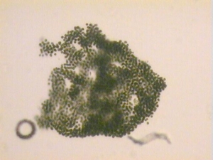 Microcystis_aeruginosa1l.jpg